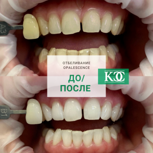 До/после До/после